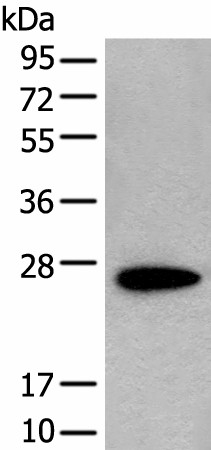 Western blot analysis of NIH/3T3 cell lysate  using CD63 Polyclonal Antibody at dilution of 1:250