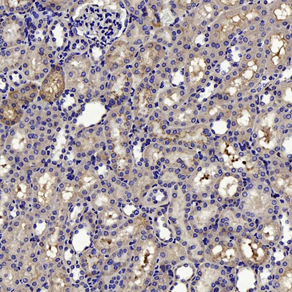 Immunohistochemistry analysis of paraffin-embedded mouse kidney  using CTGF Polyclonal Antibody at dilution of 1:100.