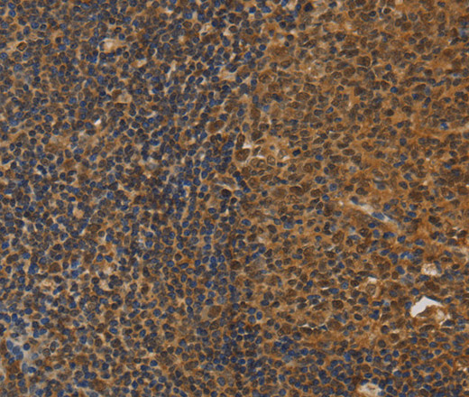 Immunohistochemistry of paraffin-embedded Human tonsil using DAB2 Polyclonal Antibody at dilution of 1:30