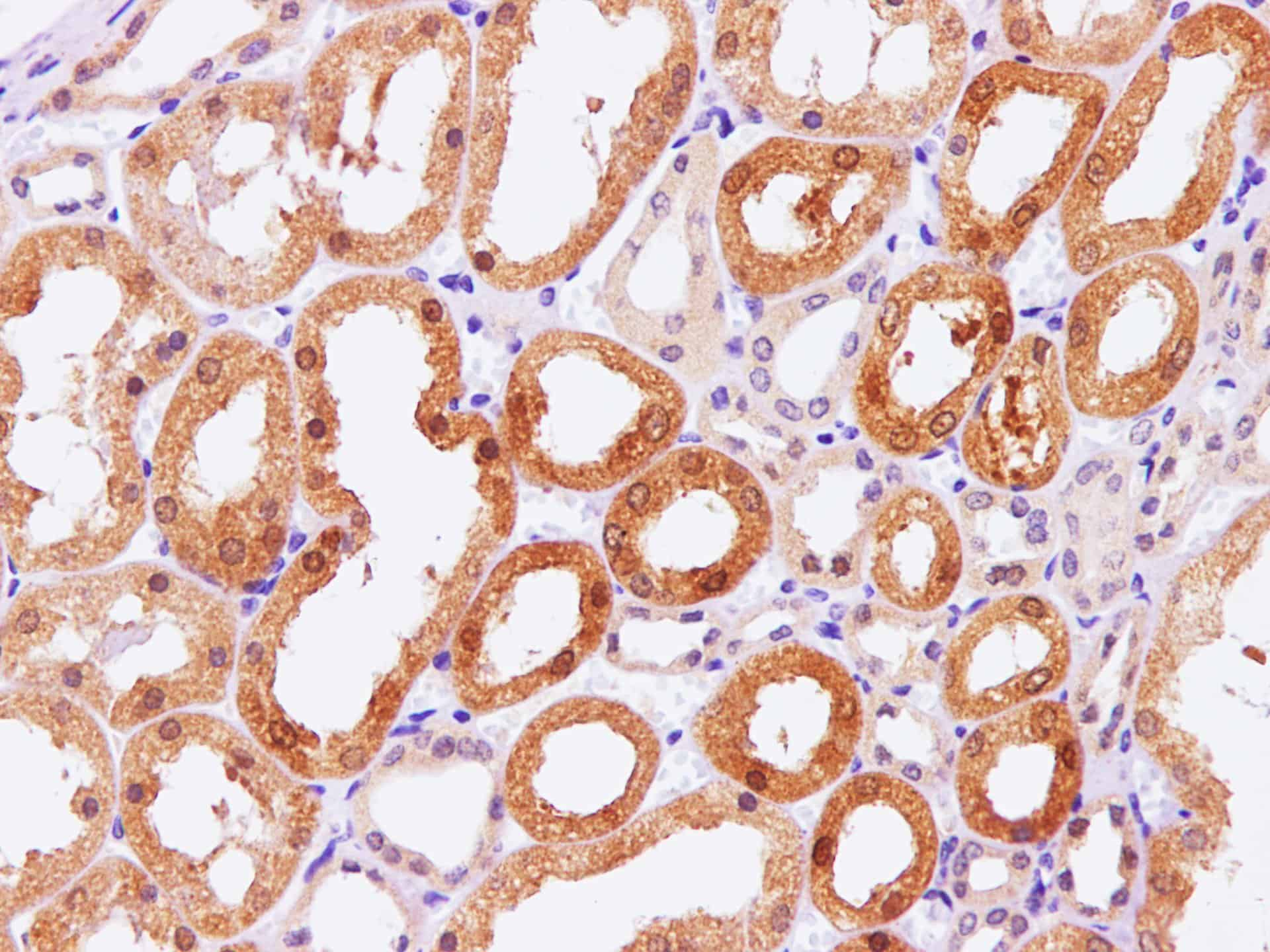 Immunohistochemistry of paraffin-embedded Human kidney using Pck1 Polyclonal Antibody at dilution of 1:100