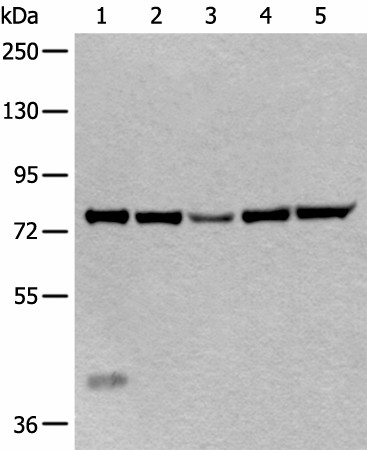 Western blot analysis of Mouse liver tissue Hela cell Human testis tissue Jurkat and HEPG2 cell lysates  using ATF6B Polyclonal Antibody at dilution of 1:300