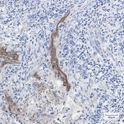 Recombinant Extracellular matrix protein 1 Monoclonal Antibody - 3
