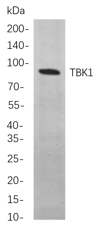 Recombinant TBK1 Monoclonal Antibody-searchlist-1