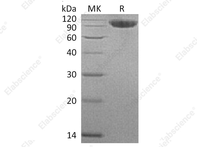 Recombinant Human CFHR4 Protein (His Tag) - 1