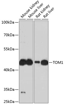 Western blot analysis of extracts of various cell lines using TOM1 Polyclonal Antibody at 1:3000 dilution.