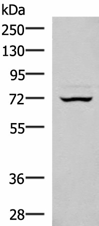 Western blot analysis of 293T cell lysate  using EIF2AK1 Polyclonal Antibody at dilution of 1:350