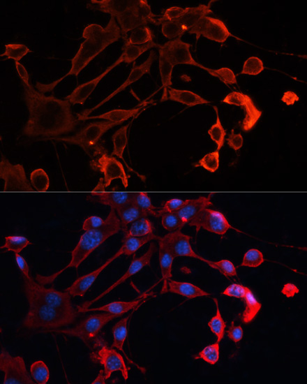 Immunofluorescence analysis of NIH/3T3 cells using ADAM11 Polyclonal Antibody at dilution of  1:100. Blue: DAPI for nuclear staining.