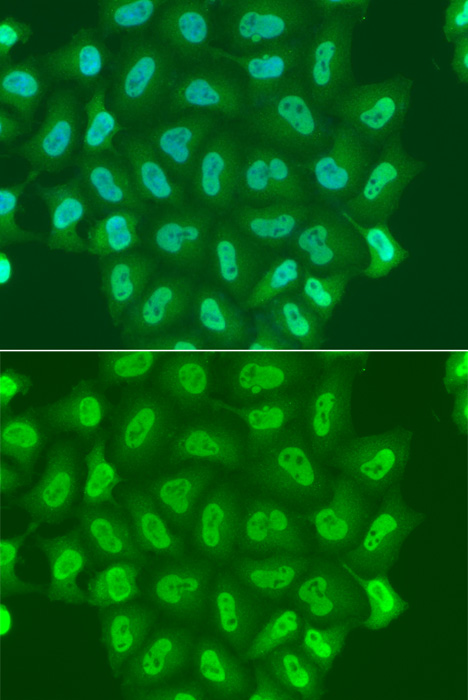 Immunofluorescence analysis of A549 cells using POLR2A Polyclonal Antibody