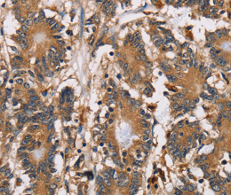 HTR3C Polyclonal Antibody - 3