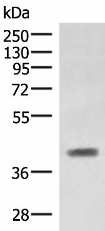 Western blot analysis of Mouse liver tissue lysate  using SAMSN1 Polyclonal Antibody at dilution of 1:1000