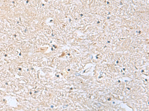 Immunohistochemistry of paraffin-embedded Human brain tissue  using EIF4A2 Polyclonal Antibody at dilution of 1:70(?200)