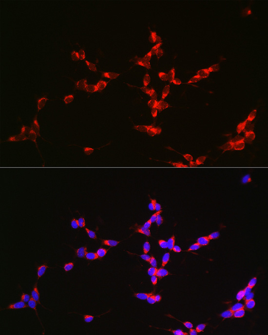 Immunofluorescence analysis of SH-SY5Y cells using Glutaminase (GLS) Polyclonal antibody at dilution of 1:150. Blue: DAPI for nuclear staining.