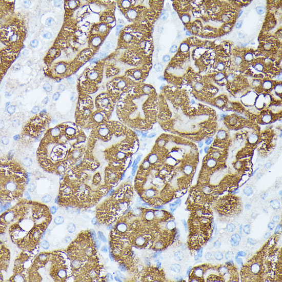 Immunohistochemistry of paraffin-embedded Mouse kidney using PLS1 Polyclonal Antibody at dilution of  1:100 (40x lens).