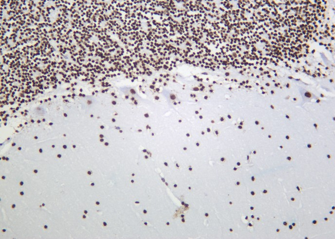 Recombinant Histone H3 (Tri Methyl Lys9) Monoclonal Antibody-searchlist-1