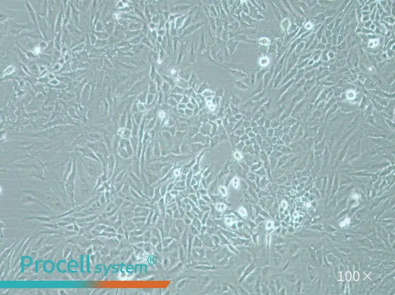 Hela Cell Complete Medium - 1