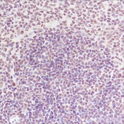 Recombinant NPM1 Monoclonal Antibody - small - 4