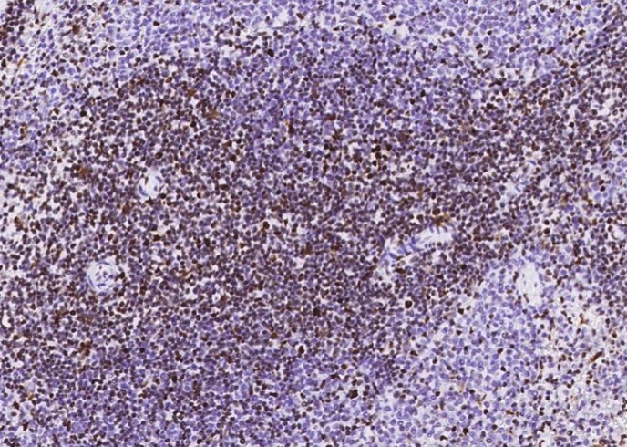 Recombinant MSH6/GTBP Monoclonal Antibody - small - 8