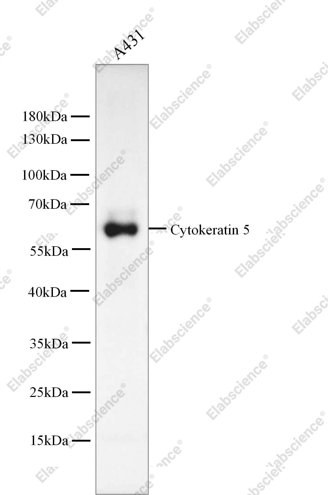 Recombinant Cytokeratin 5/KRT5 Monoclonal Antibody - 3