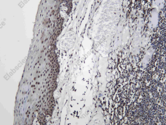 Recombinant EWS Monoclonal Antibody - 2