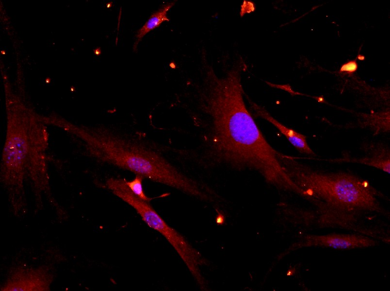Mouse Synovial Cell Complete MediumMouse Synovial Cell Complete Medium - 2