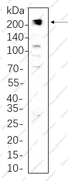 Recombinant PDGFR-β Monoclonal Antibody - 1