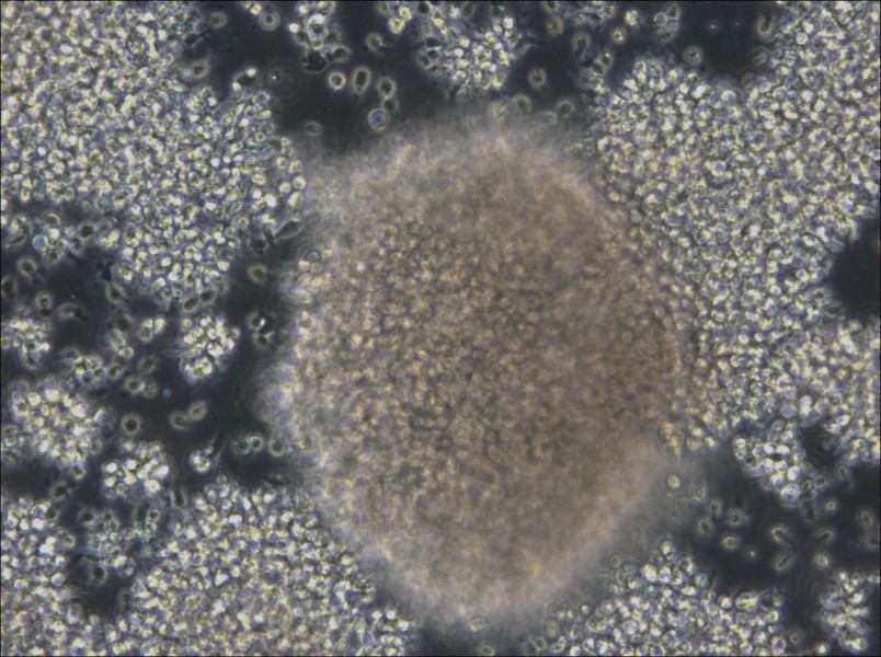 NCI-BL2009 Cell Complete Medium - small - 5