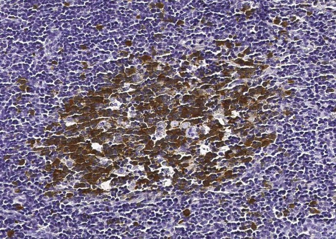 Recombinant RRM2B/P53R2 Monoclonal Antibody-searchlist-1