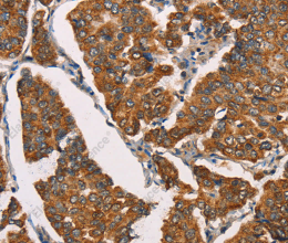 SPR Polyclonal Antibody - 2