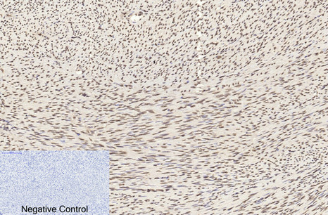 Immunohistochemistry of paraffin-embedded Human uterus tissue using Histone H3 Monoclonal Antibody at dilution of 1:200.