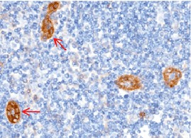 Recombinant CD146/MCAM Monoclonal Antibody - small - 2