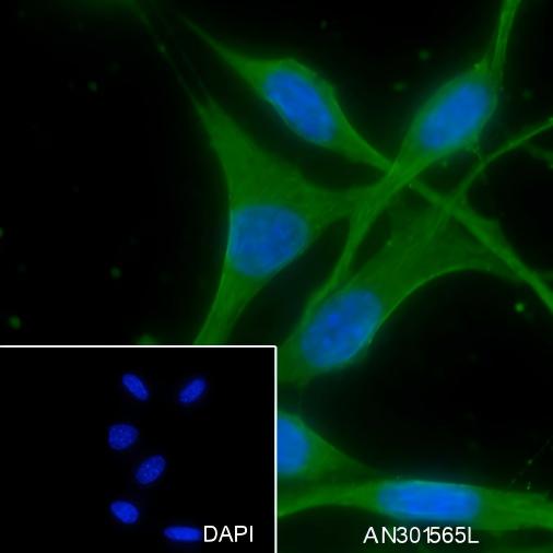 Recombinant IMPDH2 Monoclonal Antibody - small - 2