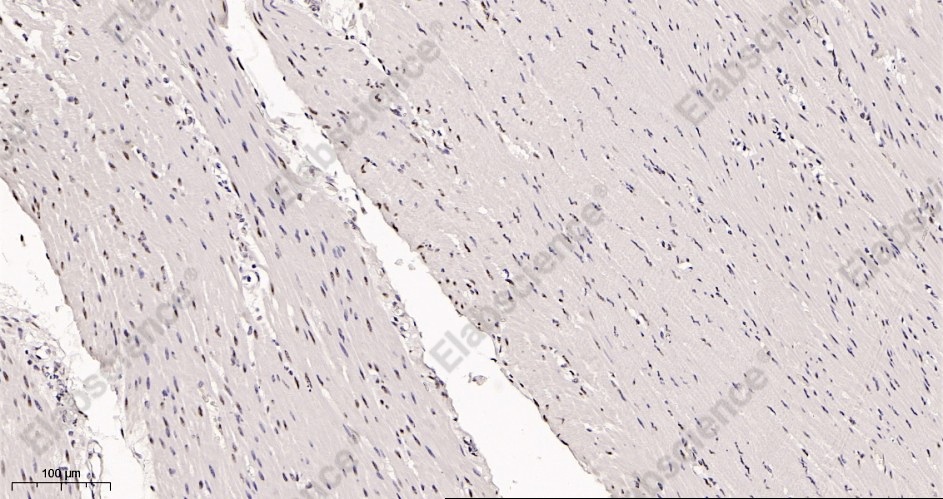 Recombinant AREB6 Monoclonal Antibody - 2