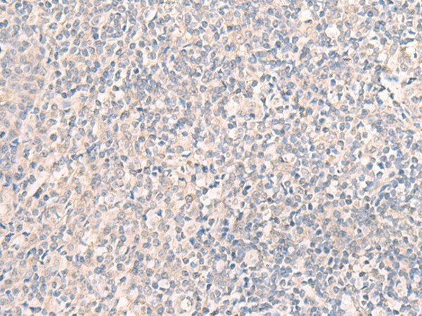 Immunohistochemistry of paraffin-embedded Human tonsil tissue  using CCDC47 Polyclonal Antibody at dilution of 1:25(?200)