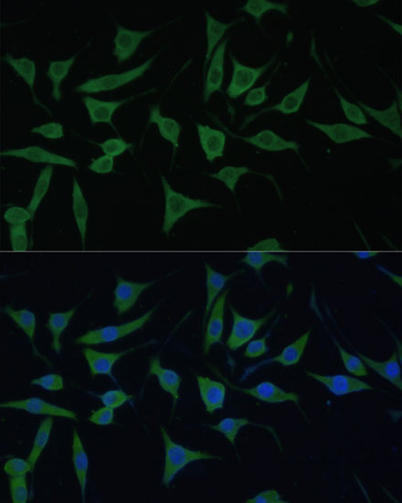 Immunofluorescence analysis of L929 cells using HIBCH Polyclonal Antibody at dilution of 1:100. Blue: DAPI for nuclear staining.