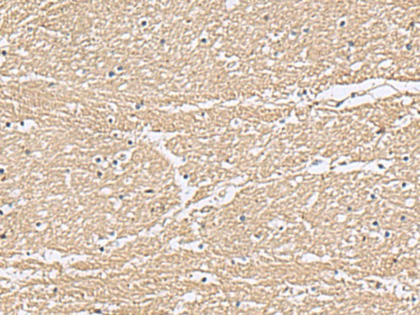 Immunohistochemistry of paraffin-embedded Human brain tissue  using KCTD7 Polyclonal Antibody at dilution of 1:55(?200)