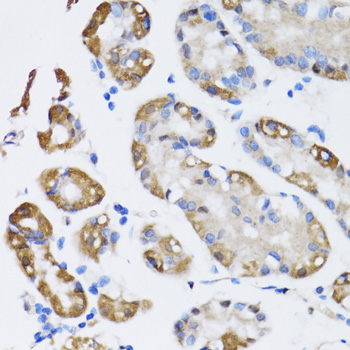 Immunohistochemistry of paraffin-embedded Human stomach using NAA10 Polyclonal Antibody at dilution of 1:100 (40x lens).
