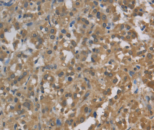 Cytochrome b5 Polyclonal Antibody - 2