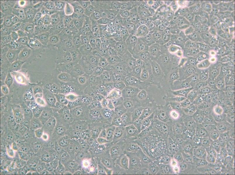 KYSE-30 Cell Complete Medium - small - 4