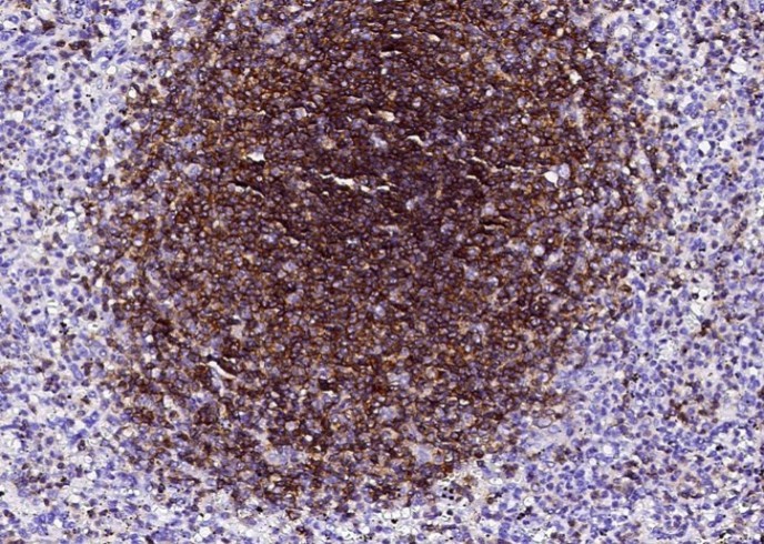 Recombinant Ly108/SLAMF6 Monoclonal Antibody - small - 2