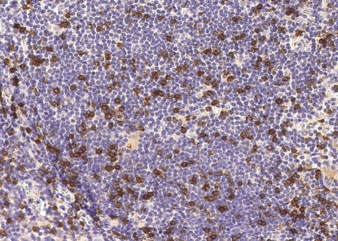 Recombinant CD8B/P37/LEU2 Monoclonal Antibody - small - 2