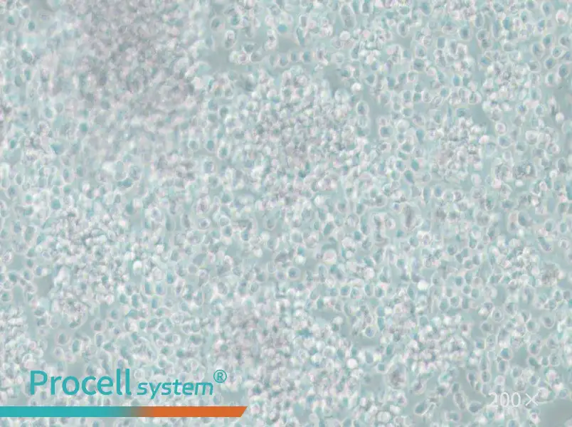 CCRF-SB Cell Complete Medium - 5