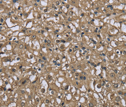 FBP1 Polyclonal Antibody - 2