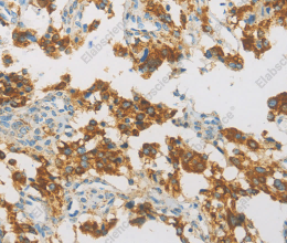 IDH3G Polyclonal Antibody - 3