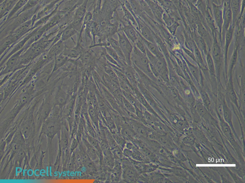 Human Esophageal Cancer Fibroblast Complete Medium - 6