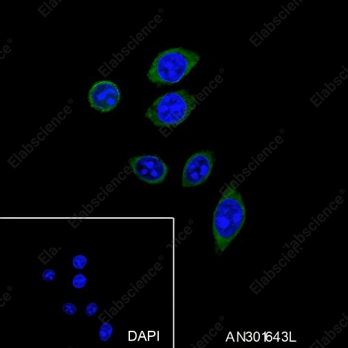 Recombinant Phospho-PTP1B (Ser386) Monoclonal Antibody - 4