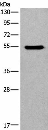 Western blot analysis of HEPG2 cell lysate  using CYP11B2 Polyclonal Antibody at dilution of 1:650