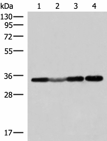 Western blot analysis of 293T and Hela cell Human fetal liver tissue lysates  using ECH1 Polyclonal Antibody at dilution of 1:300