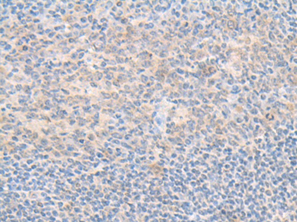 Immunohistochemistry of paraffin-embedded Human tonsil tissue  using SMS Polyclonal Antibody at dilution of 1:70(?200)