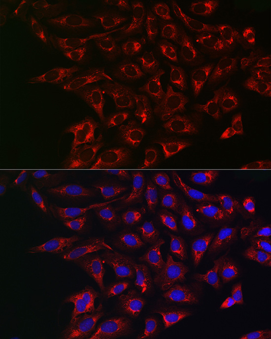 Immunofluorescence analysis of U2OS cells using ABCG2 Polyclonal Antibody at dilution of 1:200 (40x lens). Blue: DAPI for nuclear staining.