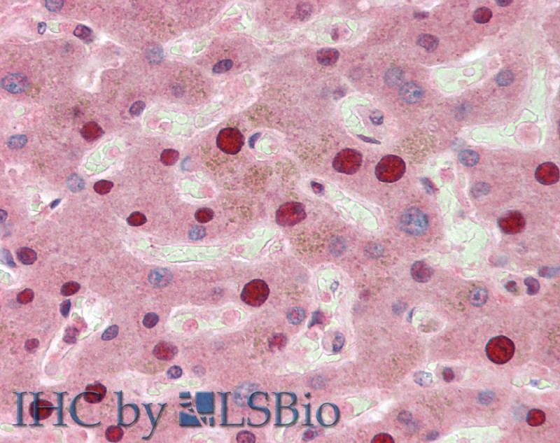 Immunohistochemistry of paraffin-embedded Liver tissue using TP53INP1 Polyclonal Antibody at dilution of 1:50(Elabscience Product Detected by Lifespan).